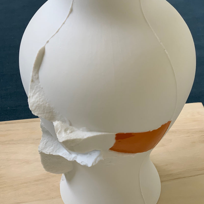 Vases - Fragment(s) Large - Edition 32